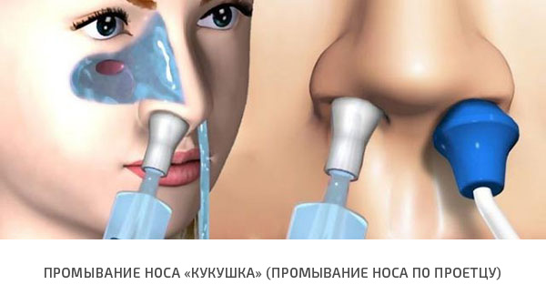 Кукушка - промывание носа в Москве, Куркино и Химках